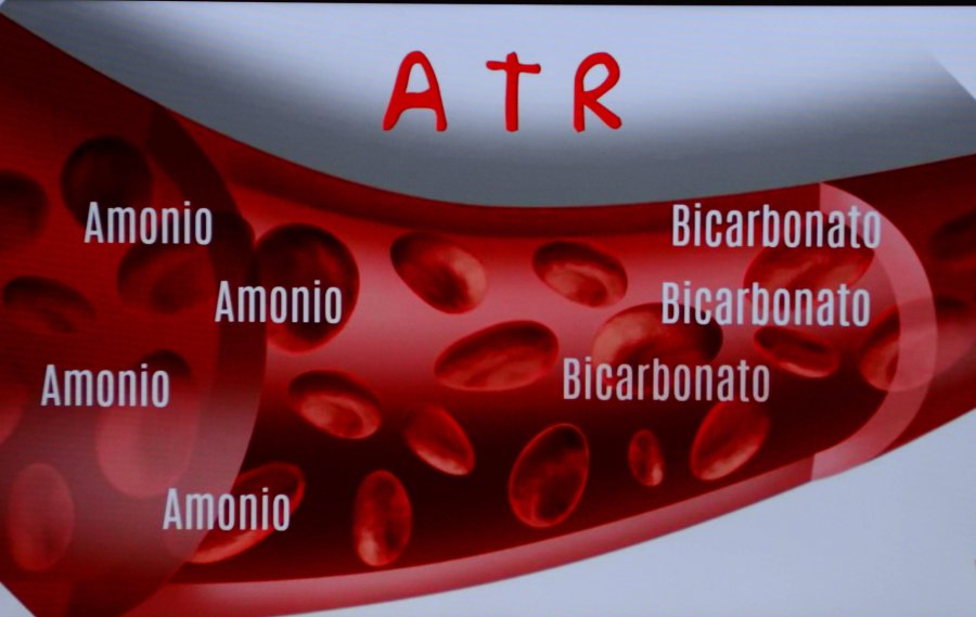 DESARROLLA LA UNAM EL PRIMER ESTUDIO QUE IDENTIFICA GENES QUE PRODUCEN AFECCIÓN RENAL EN NIÑOS MEXICANOS