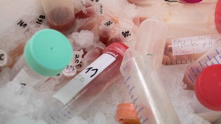 CONFIRMAN POLITÉCNICOS EFECTO HEPATOPROTECTOR DEL EXTRACTO DE GERANIO