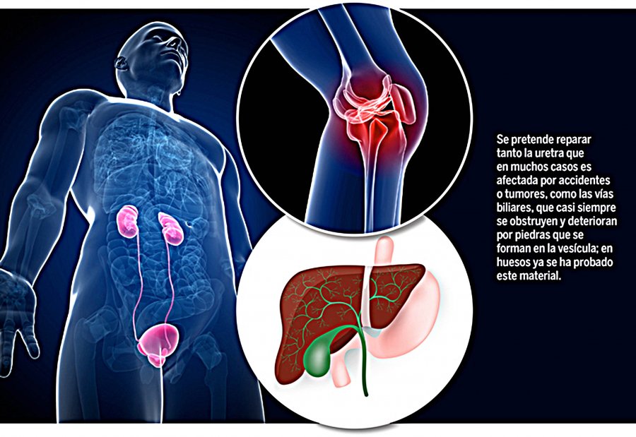 CREAN CIENTÍFICOS DE LA UNAM BIOPRÓTESIS PARA REGENERAR TEJIDOS