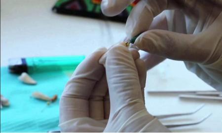 PRUEBA UNAM NANOPARTÃCULAS DE PLATA Y COBRE PARA NUEVOS MATERIALES DENTALES ANTIMICROBIANOS