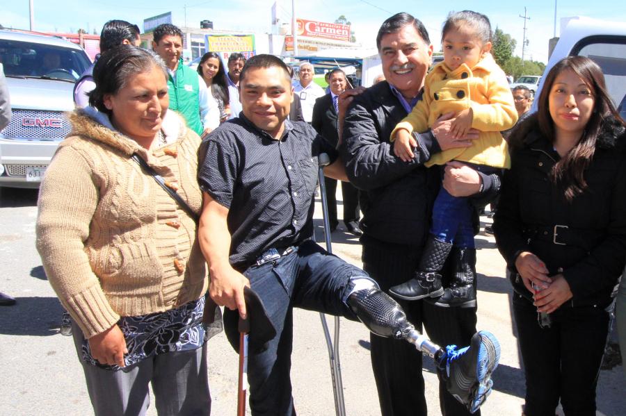 AGRADECE BRAULIO MATEO A MGZ SU APOYO PARA OBTENER UNA PRÃ“TESIS DE PIERNA