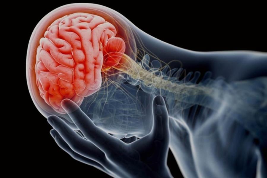 LAS CONMOCIONES CEREBRALES EN EL FUTBOL SON FRECUENTES Y REQUIEREN ATENCIÓN HOSPITALARIA