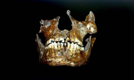 SERVICIO ARQUEOMAGNÃ‰TICO NACIONAL DE LA UNAM DESCUBRE TRATAMIENTO DENTAL MÃS ANTIGUO EN AMÃ‰RICA