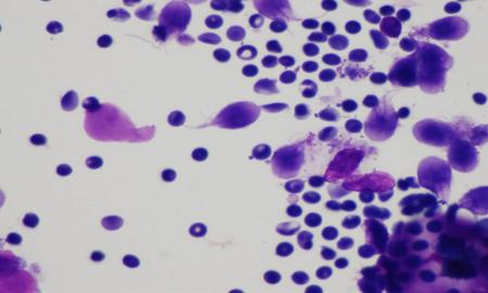 DESCUBREN UNIVERSITARIOS ESTRUCTURA CELULAR PERSISTENTE DE UN PARÃSITO QUE CAUSA DIARREA INFANTIL