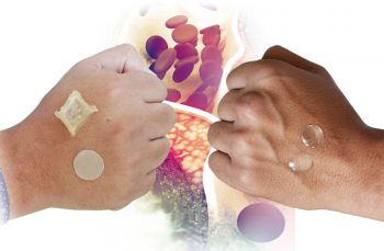 CREAN ACADÉMICOS DE LA UNAM PARCHE TRANSDÉRMICO PARA COMBATIR COLESTEROL Y TRIGLICÉRIDOS