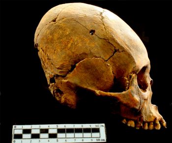 INDAGAN LA DIETA DE LOS ANTIGUOS TEOTIHUACANOS CON ANÁLISIS MICROBOTÁNICO DE CÁLCULOS DENTALES