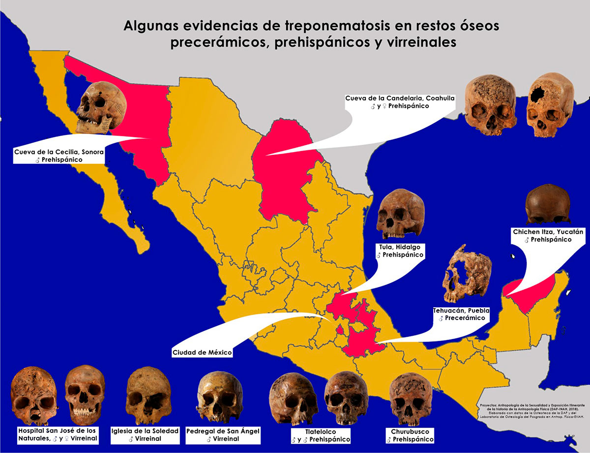 Exposición muestra evidencias de infecciones en restos óseos antiguos hallados en México