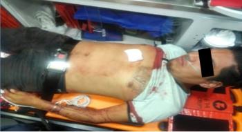 Policías de la SSC apoyan a una persona que sufrió una caída y se lesionó con un objeto punzocortante