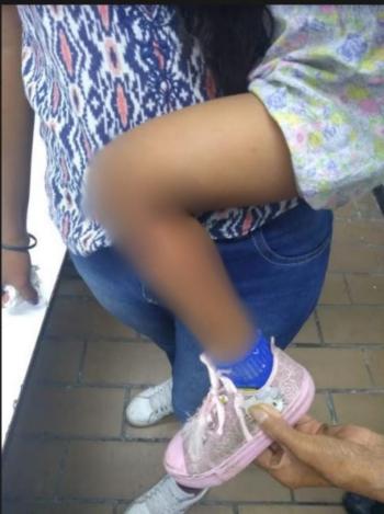 Policías de la PBI de la SSC Auxilian a Niña lesionada en la estación Viveros