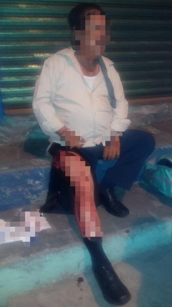 Policías de la SSC brindan apoyo a Taxista Lesionado en la Alcaldía Iztapalapa