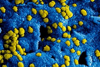 Ante coronavirus, recomienda CAPV-UNAM extremar precauciones al viajar a Asia Oriental e Insular