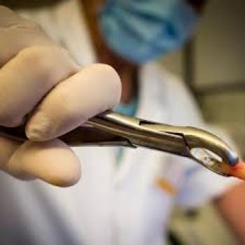 Entre los 20 y 30 años se presenta la mayor pérdida de piezas dentales