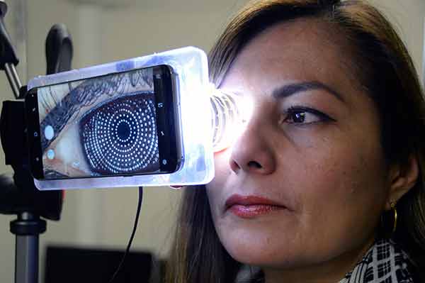 Desarrolla UNAM topógrafo con cámara de celular para evaluar la forma de la cornea