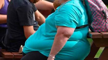 Obesidad, kilos de razones para tomarla en serio