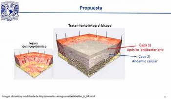 Estudian en la UNAM materiales para curar quemaduras graves