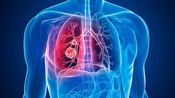 ¿Cáncer a temprana edad?