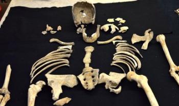 Examinan el aspecto ético en el manejo y la formación de las colecciones de restos humanos