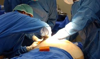 Instituto Nacional de Rehabilitación implementa sistema de registro intrahospitalario para trasplante de tejidos y células