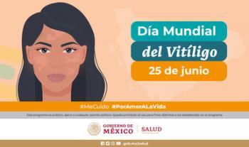 Importante dar enfoque integral a la atención del vitiligo