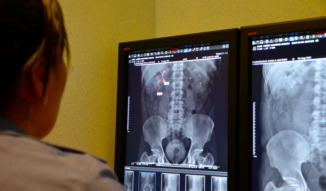 Radiología, herramienta para diagnóstico y seguimiento a problemas de salud