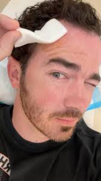 Kevin Jonas de los Jonas Brothers revela su lucha contra el cáncer de piel
