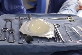 Hospital Rubén Leñero ofrece reconstrucción mamaria gratuita en Ciudad de México