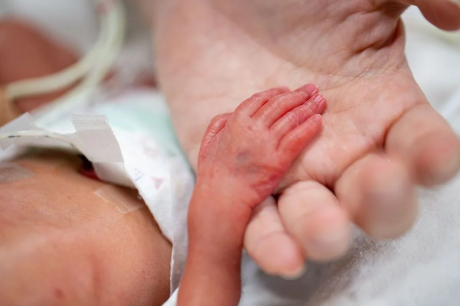 Exigen tamiz oftalmológico en bebés prematuros para prevenir ceguera
