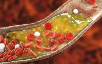 Triglicéridos altos: causas, riesgos y cómo reducirlos de forma efectiva