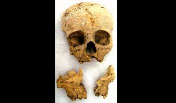 Estudio dental revela diversidad infantil y posible origen migrante en sacrificios de Chichén Itzá