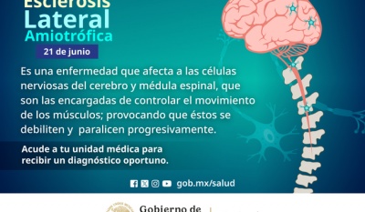 Hospital General de México brinda atención especializada a pacientes con ELA