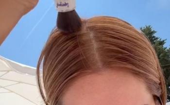 Raya del cabello y labios: las zonas olvidadas que debes proteger del sol