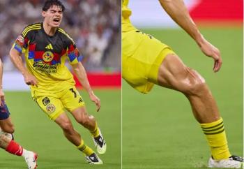 Dagoberto Espinoza sufre lesión de ligamento y estará fuera seis a ocho meses