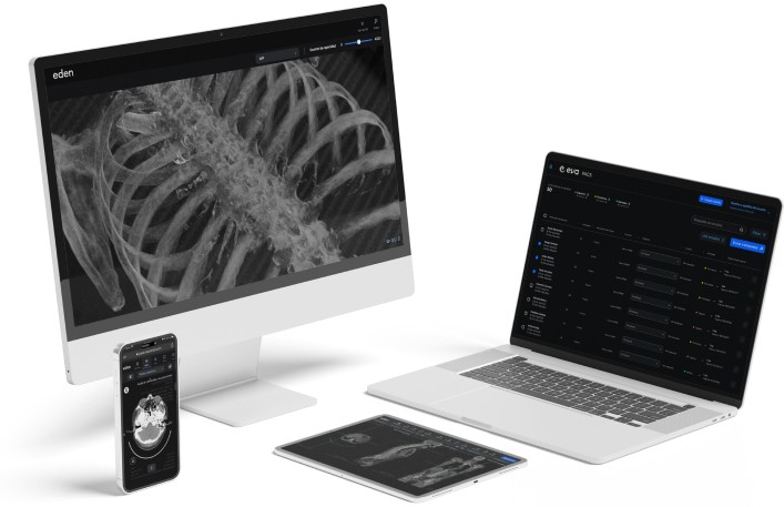 Eden revoluciona la radiología con inteligencia artificial para diagnósticos más precisos