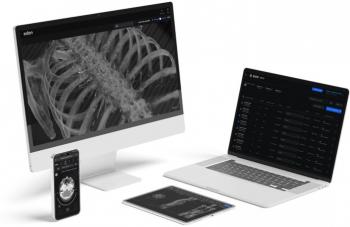 Eden revoluciona la radiología con inteligencia artificial para diagnósticos más precisos