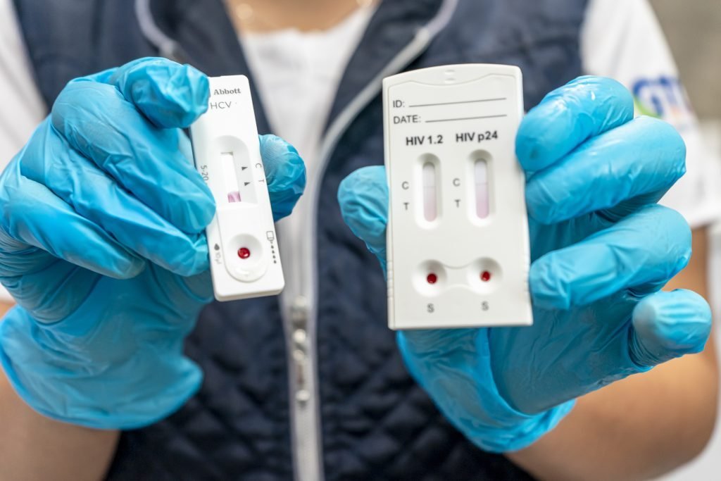 Guanajuato detecta 369 nuevos casos de VIH en 2025 con diagnóstico temprano