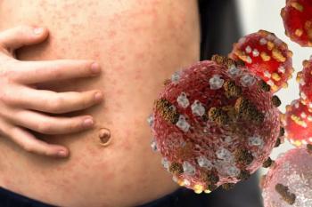 SSA alerta por alta contagiosidad del sarampión y refuerza llamado urgente a la vacunación en México