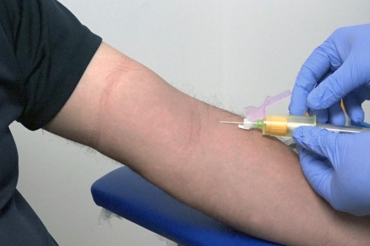 Gobierno de Colima invita a varones a valoraci&oacute;n m&eacute;dica anual para detecci&oacute;n de hiperplasia prost&aacute;tica