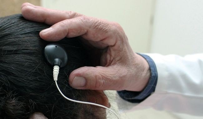 IMSS Jalisco realiza 70 implantes cocleares pediátricos y se consolida como Centro de Referencia Nacional