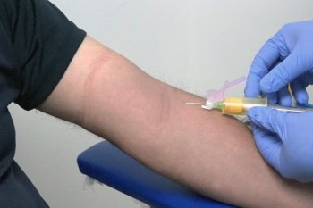 Gobierno de Colima invita a varones a valoración médica anual para detección de hiperplasia prostática