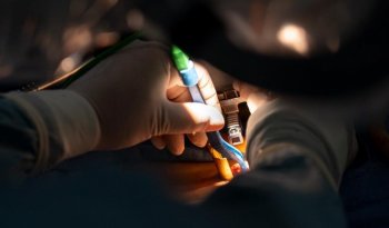 ISSSTE extirpa tumor de médula espinal a profesor con cirugía de mínima invasión