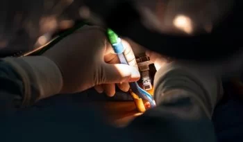 ISSSTE extirpa tumor de médula espinal a profesor con cirugía de mínima invasión