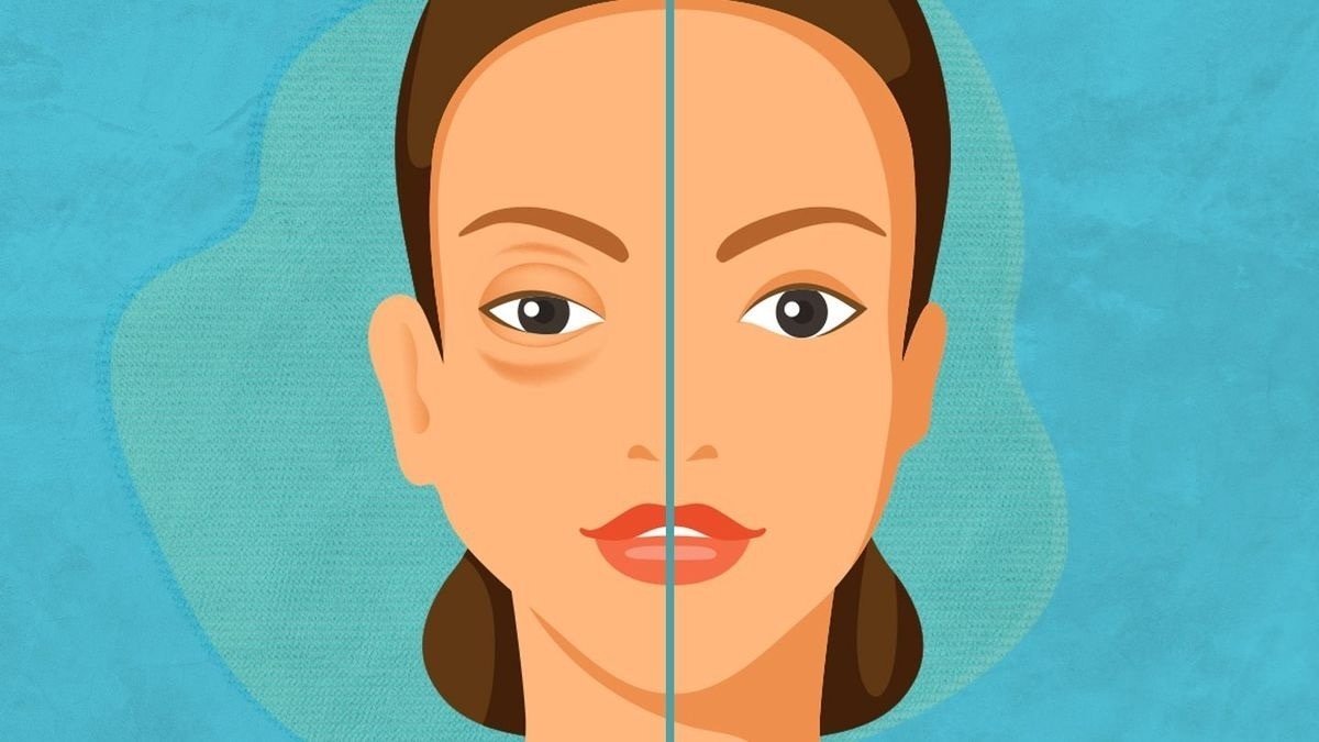 Querétaro se suma al Día Mundial del Angioedema Hereditario; llama a detección oportuna