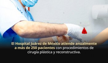 Hospital Juárez de México, referente nacional en cirugía reconstructiva: atiende más de 250 pacientes al año