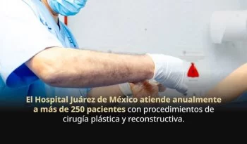 Hospital Juárez de México, referente nacional en cirugía reconstructiva: atiende más de 250 pacientes al año
