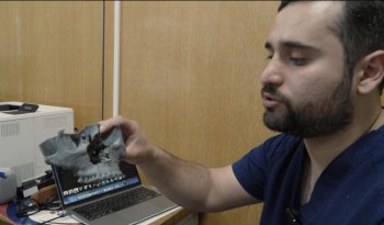 IMSS realiza cirugía ortognática de alta complejidad a paciente con asimetría facial