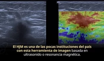 Elastografía: técnica no invasiva que revoluciona el diagnóstico temprano de fibrosis hepática en México