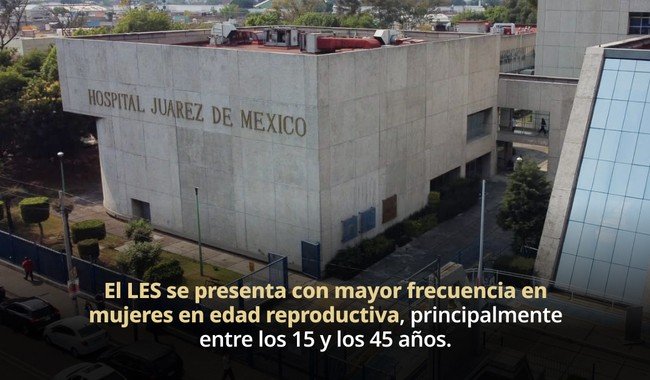 Lupus afecta más a mujeres jóvenes; diagnóstico temprano es clave: especialista