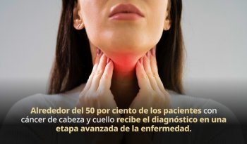 Cáncer de cabeza y cuello: 20 mil casos anuales en México; el 75% por tabaco, alcohol y VPH