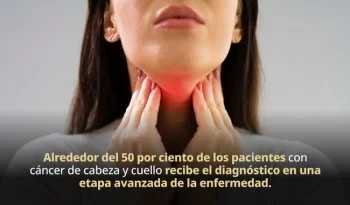 Cáncer de cabeza y cuello: 20 mil casos anuales en México; el 75% por tabaco, alcohol y VPH