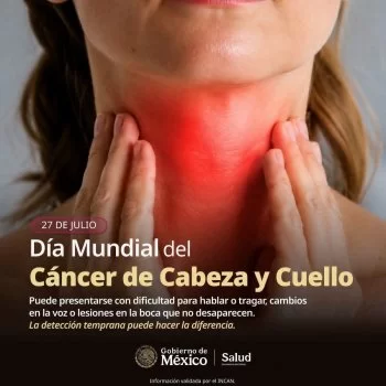 SESA Querétaro conmemora Día Mundial del Cáncer de Cabeza y Cuello; llama a detección oportuna
